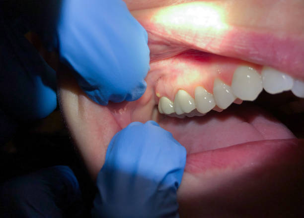 Best Emergency Root Canal Treatment in Madison, MS